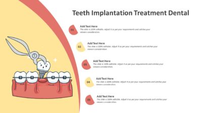 Teeth Implantation Treatment Dental PowerPoint Template