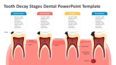 Tooth Decay Stages Dental PowerPoint Template